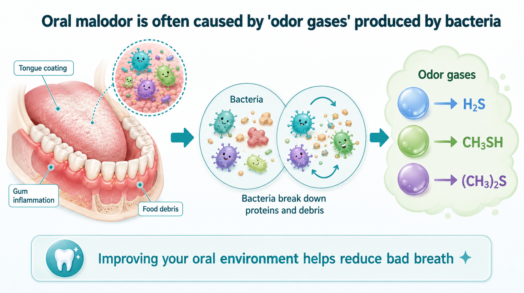 Diagram of oral malodor sources